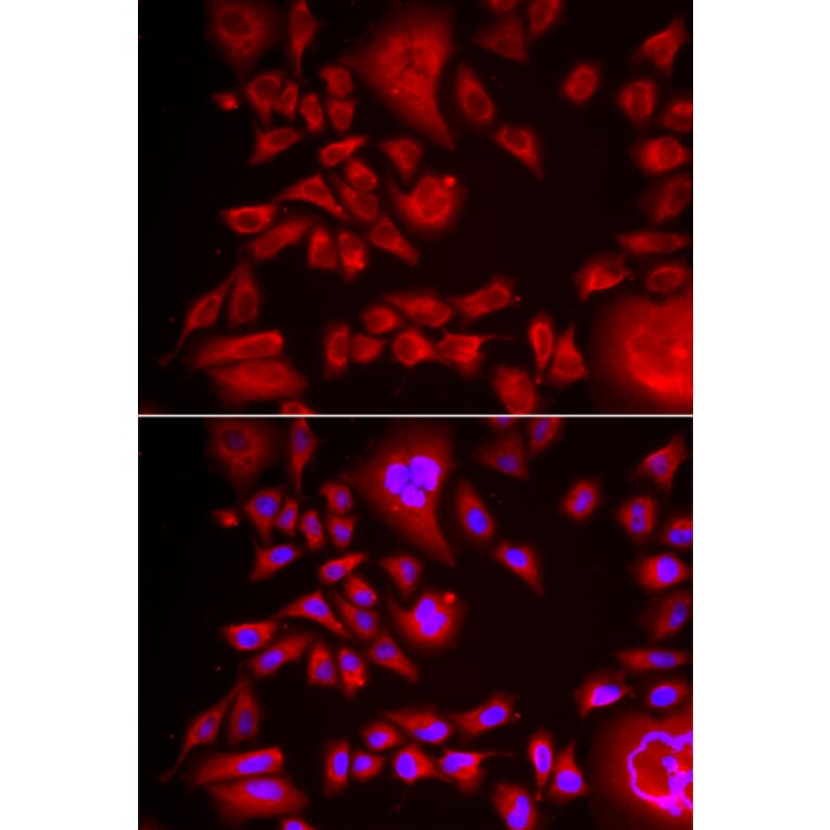Immunofluorescence - BLMH antibody from Signalway Antibody (38988) - Antibodies.com