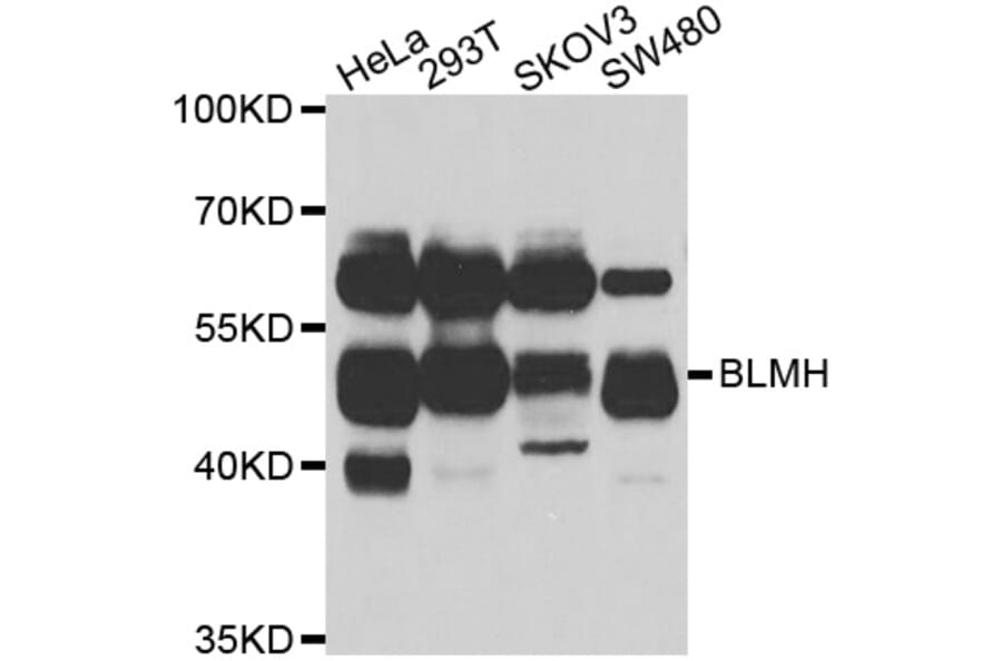 Western blot - BLMH antibody from Signalway Antibody (38988) - Antibodies.com