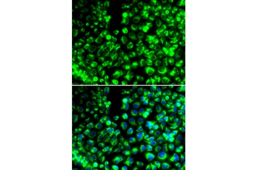 Immunofluorescence - CALU antibody from Signalway Antibody (38991) - Antibodies.com