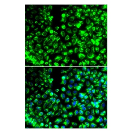 Immunofluorescence - CALU antibody from Signalway Antibody (38991) - Antibodies.com
