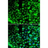 Immunofluorescence - CALU antibody from Signalway Antibody (38991) - Antibodies.com