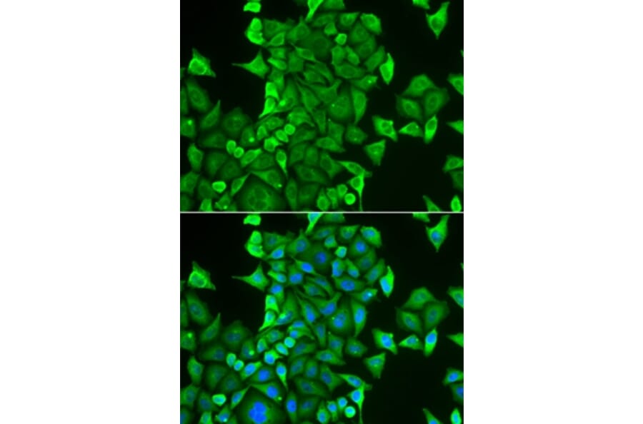 Immunofluorescence - CARS antibody from Signalway Antibody (38993) - Antibodies.com