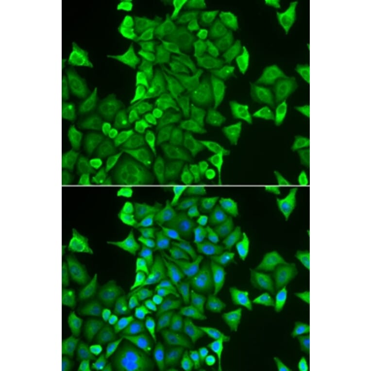 Immunofluorescence - CARS antibody from Signalway Antibody (38993) - Antibodies.com