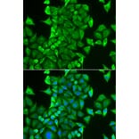 Immunofluorescence - CARS antibody from Signalway Antibody (38993) - Antibodies.com