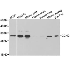 Western blot - CCNC antibody from Signalway Antibody (38997) - Antibodies.com