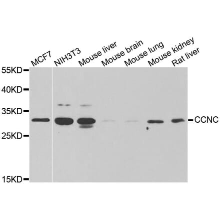 Western blot - CCNC antibody from Signalway Antibody (38997) - Antibodies.com