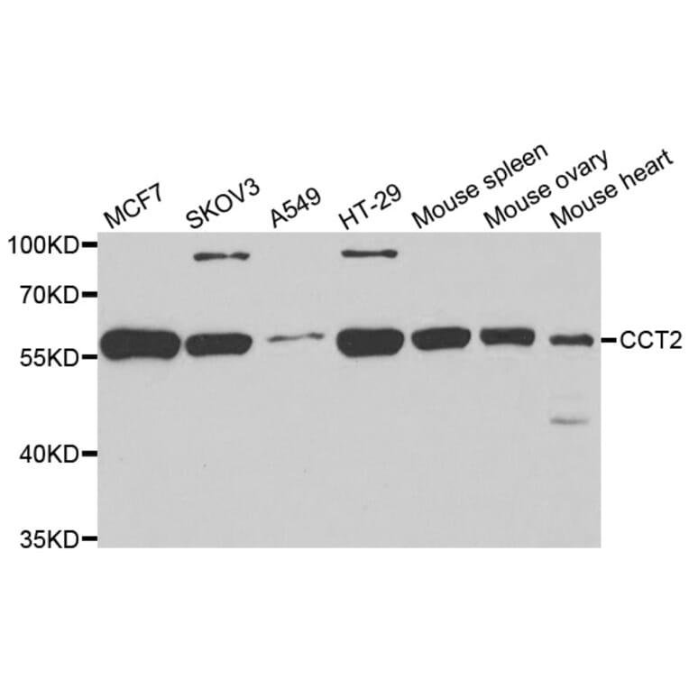 Western blot - CCT2 antibody from Signalway Antibody (38998) - Antibodies.com