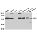 Western blot - CCT2 antibody from Signalway Antibody (38998) - Antibodies.com