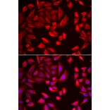 Immunofluorescence - CCT2 antibody from Signalway Antibody (38998) - Antibodies.com