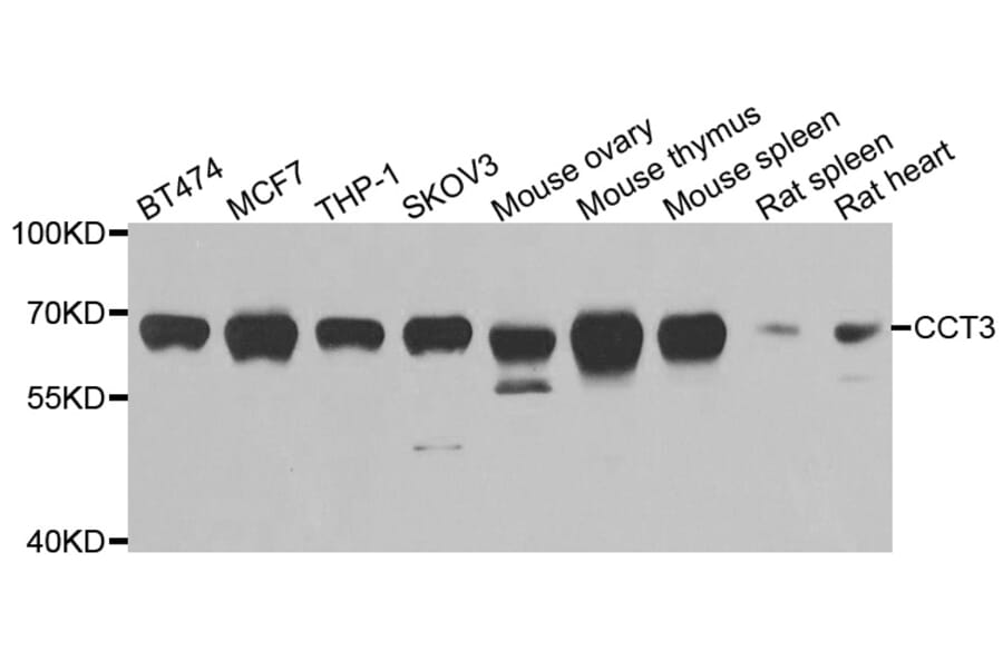 Western blot - CCT3 antibody from Signalway Antibody (38999) - Antibodies.com