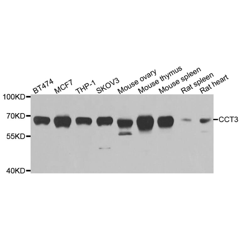 Western blot - CCT3 antibody from Signalway Antibody (38999) - Antibodies.com