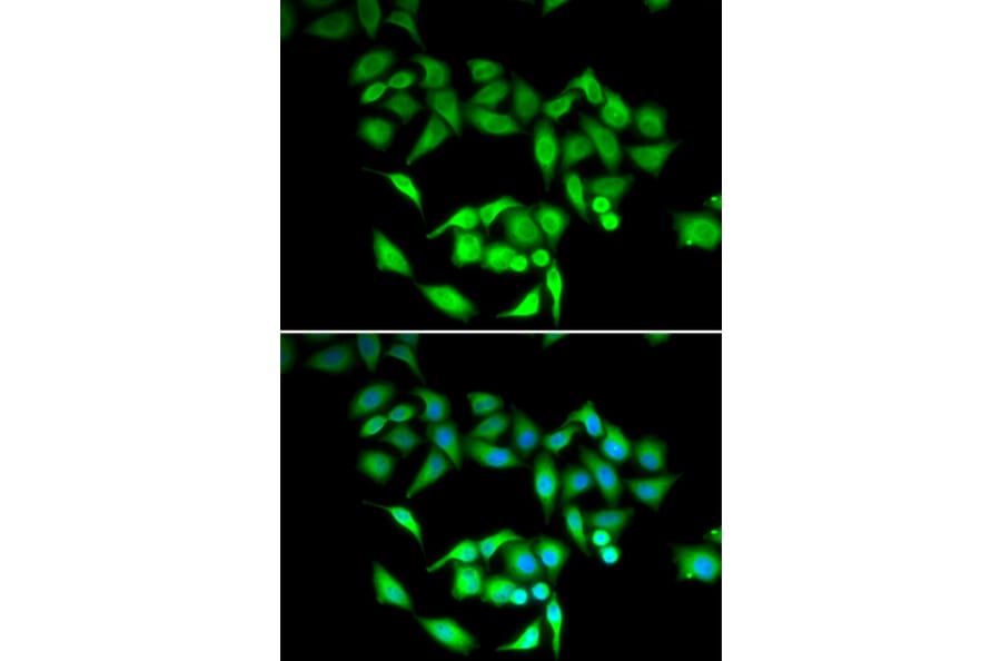 Immunofluorescence - CCT3 antibody from Signalway Antibody (38999) - Antibodies.com