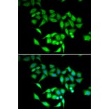 Immunofluorescence - CCT3 antibody from Signalway Antibody (38999) - Antibodies.com