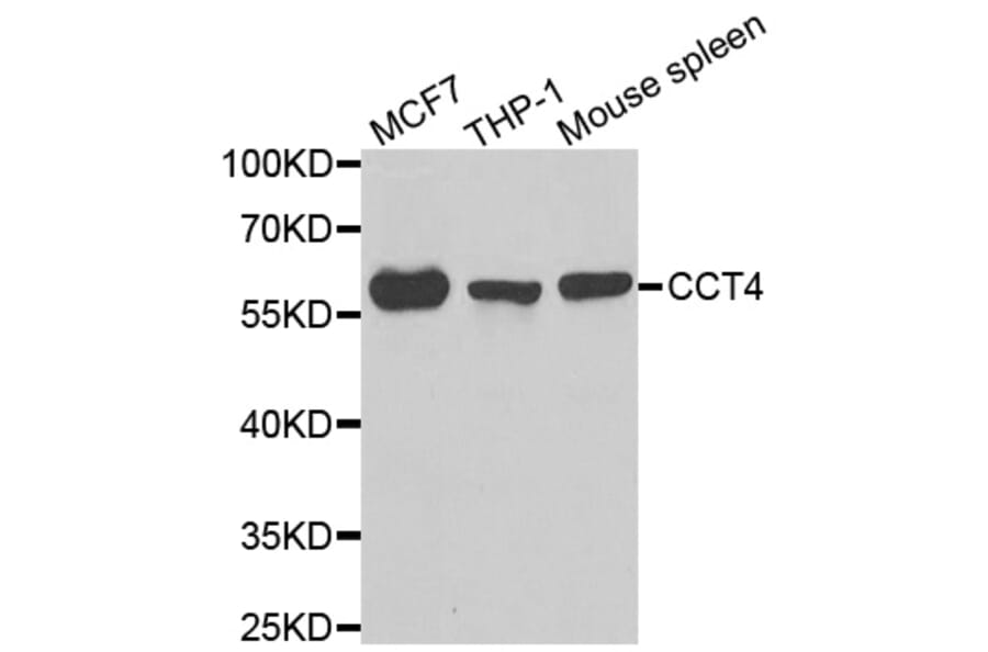 Western blot - CCT4 antibody from Signalway Antibody (39000) - Antibodies.com
