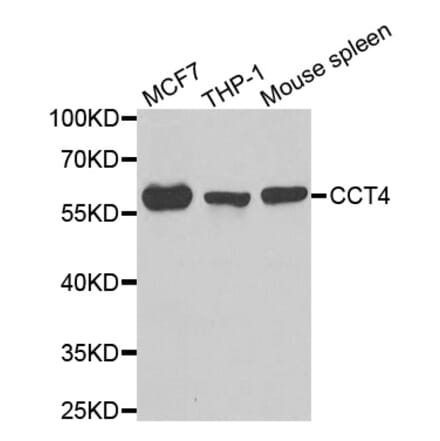 Western blot - CCT4 antibody from Signalway Antibody (39000) - Antibodies.com