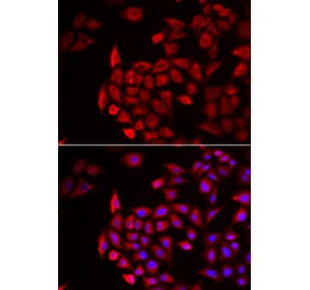 Immunofluorescence - COCH antibody from Signalway Antibody (39010) - Antibodies.com