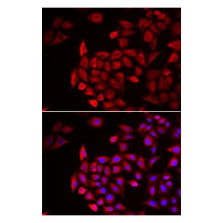 Immunofluorescence - COCH antibody from Signalway Antibody (39010) - Antibodies.com