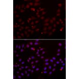 Immunofluorescence - CST2 antibody from Signalway Antibody (39016) - Antibodies.com