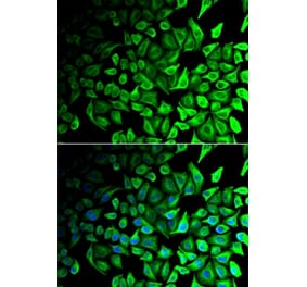 Immunofluorescence - DPP7 antibody from Signalway Antibody (39021) - Antibodies.com