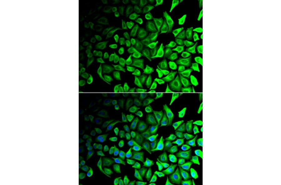Immunofluorescence - DPP7 antibody from Signalway Antibody (39021) - Antibodies.com