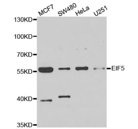 Western blot - EIF5 antibody from Signalway Antibody (39023) - Antibodies.com