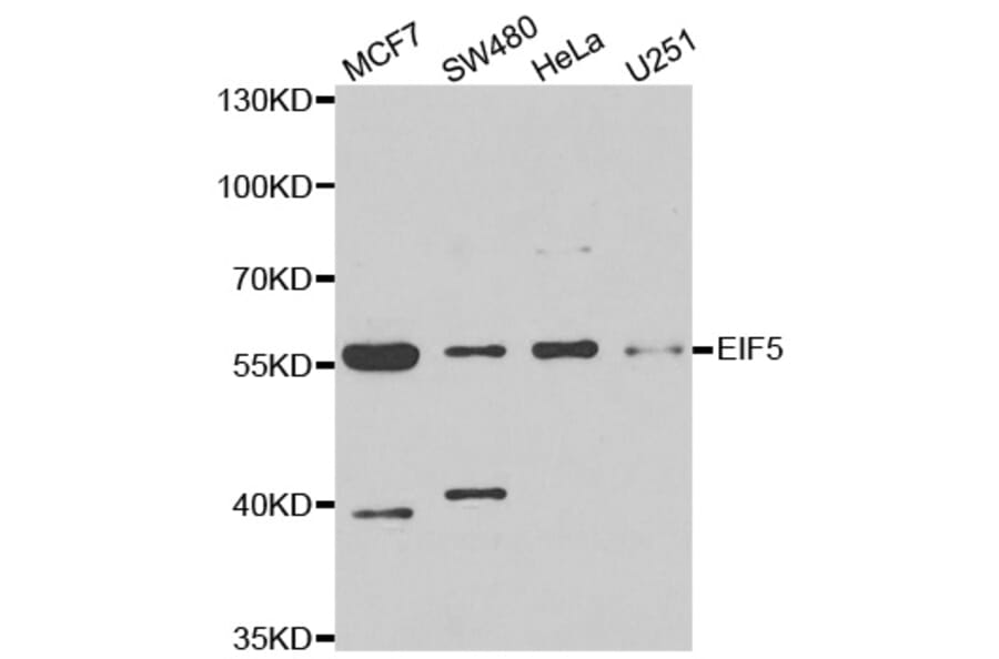 Western blot - EIF5 antibody from Signalway Antibody (39023) - Antibodies.com