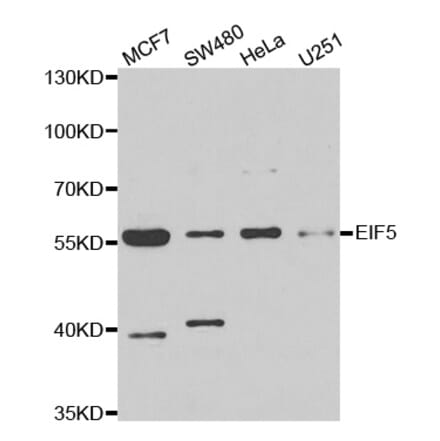 Western blot - EIF5 antibody from Signalway Antibody (39023) - Antibodies.com