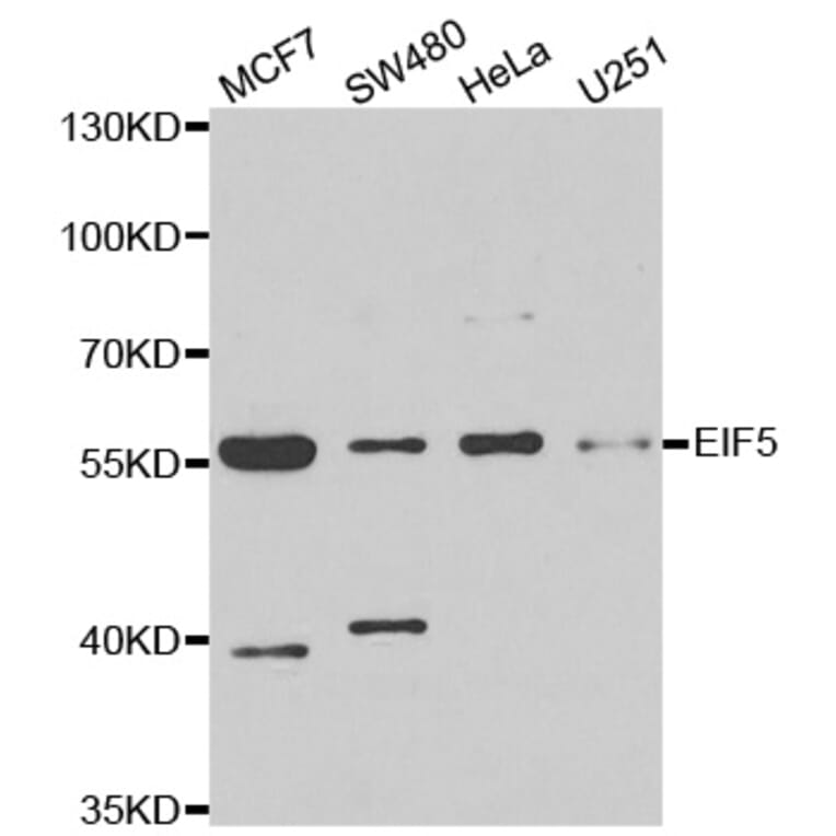 Western blot - EIF5 antibody from Signalway Antibody (39023) - Antibodies.com
