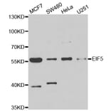 Western blot - EIF5 antibody from Signalway Antibody (39023) - Antibodies.com