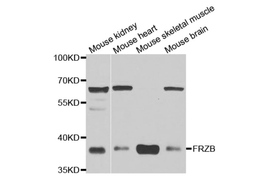 Western blot - FRZB antibody from Signalway Antibody (39030) - Antibodies.com