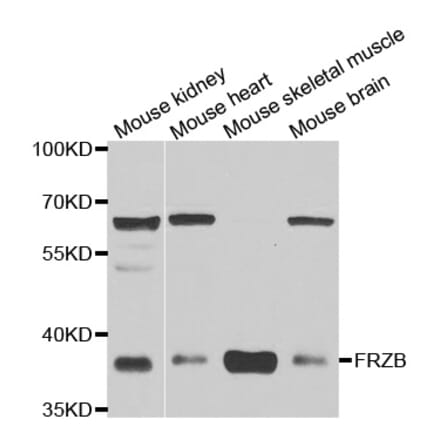 Western blot - FRZB antibody from Signalway Antibody (39030) - Antibodies.com