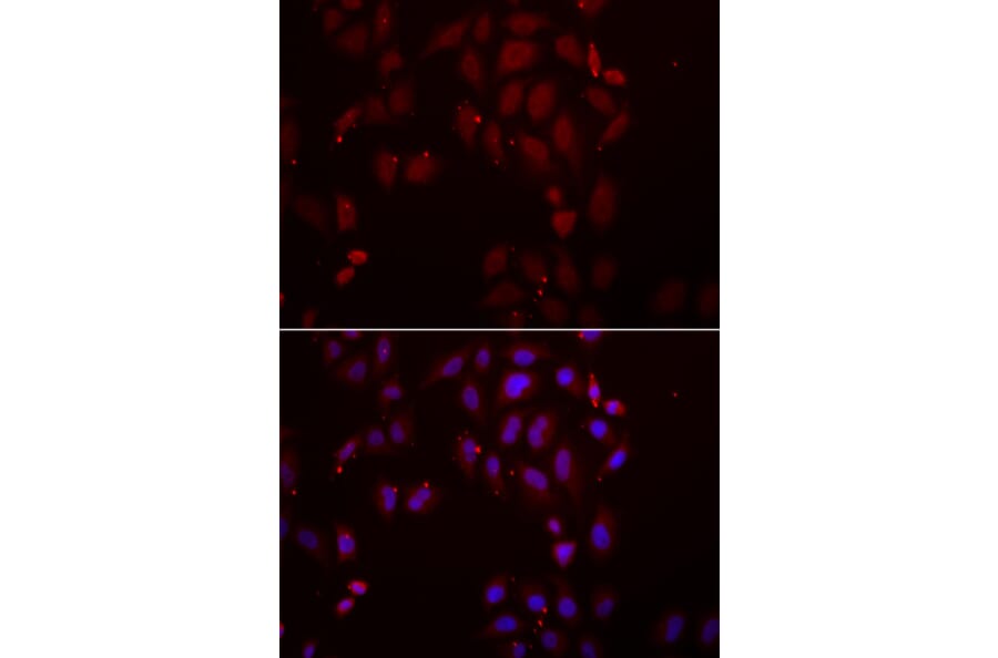 Immunofluorescence - FRZB antibody from Signalway Antibody (39030) - Antibodies.com