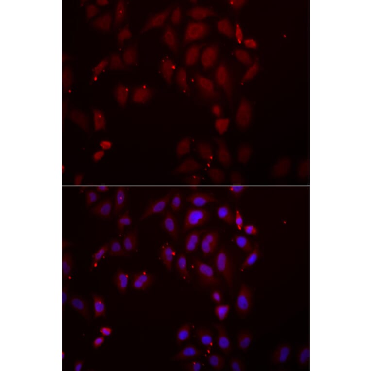 Immunofluorescence - FRZB antibody from Signalway Antibody (39030) - Antibodies.com