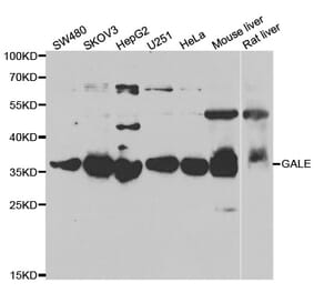 Western blot - GALE antibody from Signalway Antibody (39031) - Antibodies.com