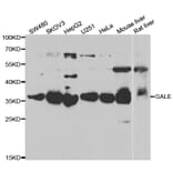 Western blot - GALE antibody from Signalway Antibody (39031) - Antibodies.com