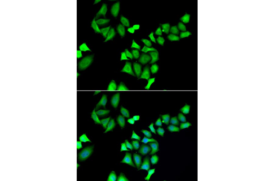 Immunofluorescence - GALE antibody from Signalway Antibody (39031) - Antibodies.com