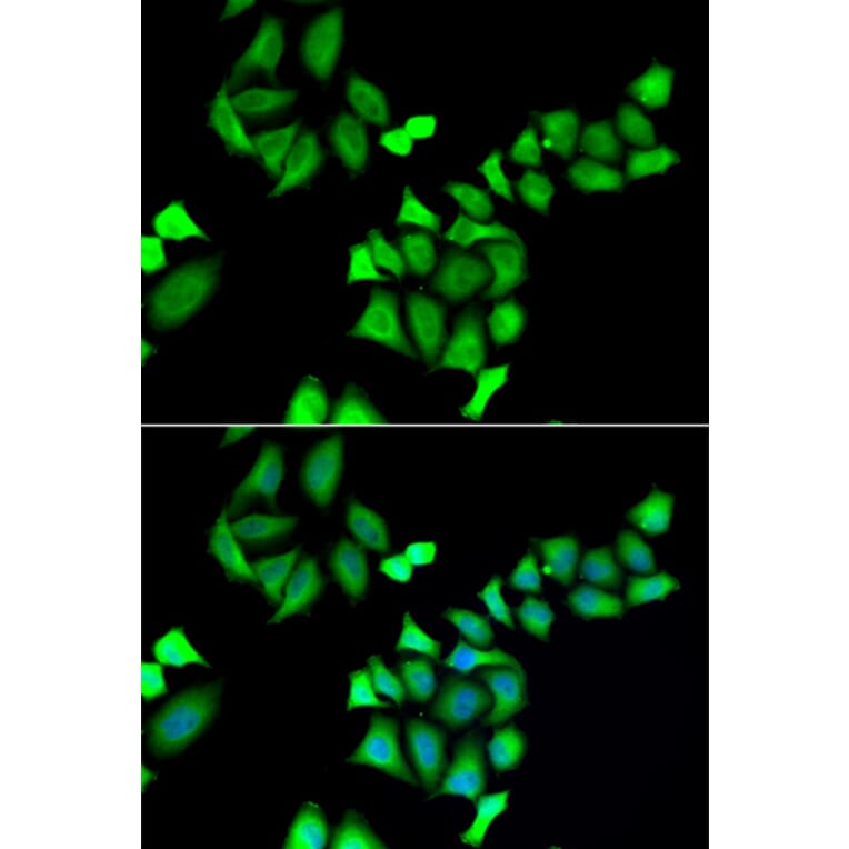 Immunofluorescence - GALE antibody from Signalway Antibody (39031) - Antibodies.com