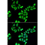 Immunofluorescence - GALE antibody from Signalway Antibody (39031) - Antibodies.com