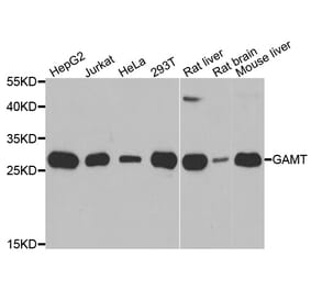 Western blot - GAMT antibody from Signalway Antibody (39033) - Antibodies.com