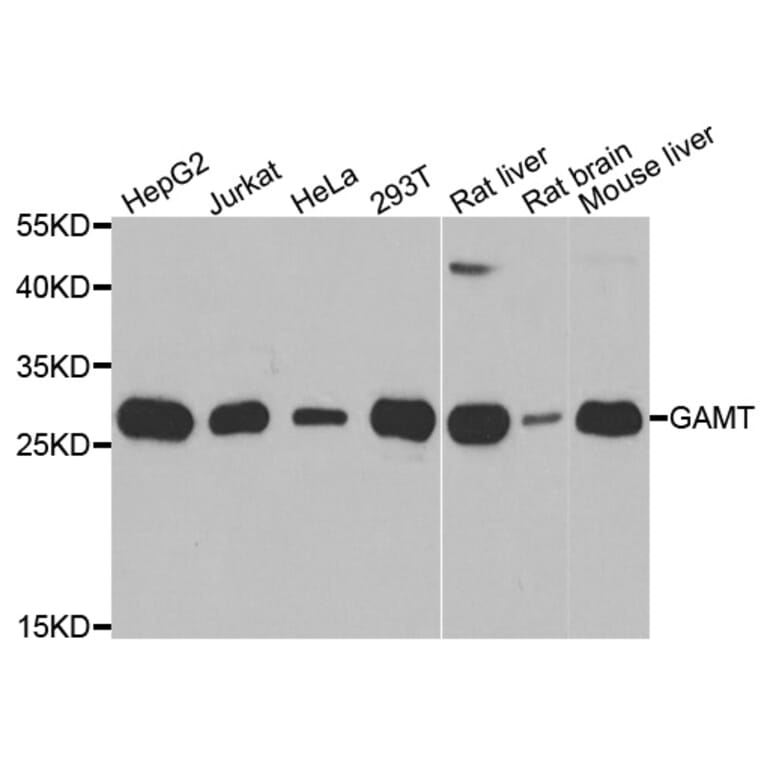 Western blot - GAMT antibody from Signalway Antibody (39033) - Antibodies.com