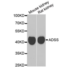 Western blot - GATM antibody from Signalway Antibody (39034) - Antibodies.com