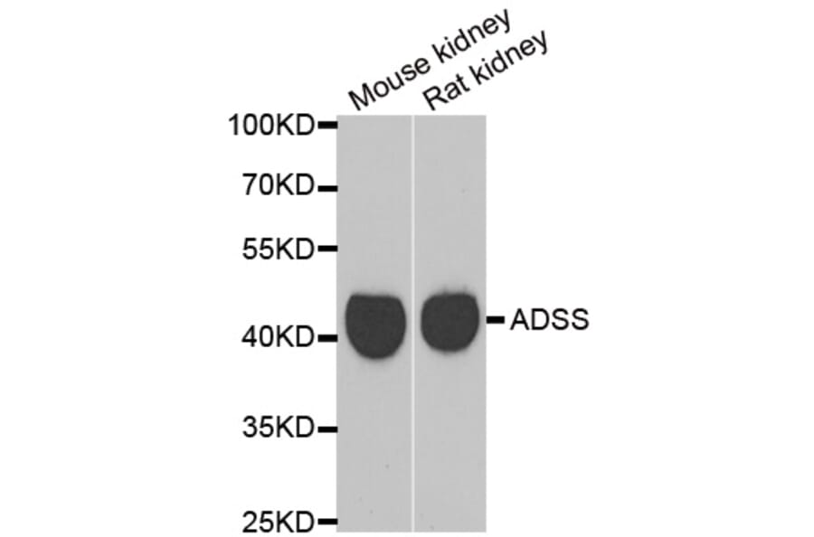Western blot - GATM antibody from Signalway Antibody (39034) - Antibodies.com