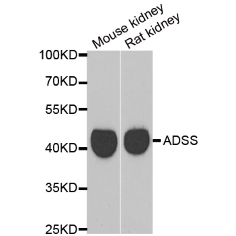Western blot - GATM antibody from Signalway Antibody (39034) - Antibodies.com