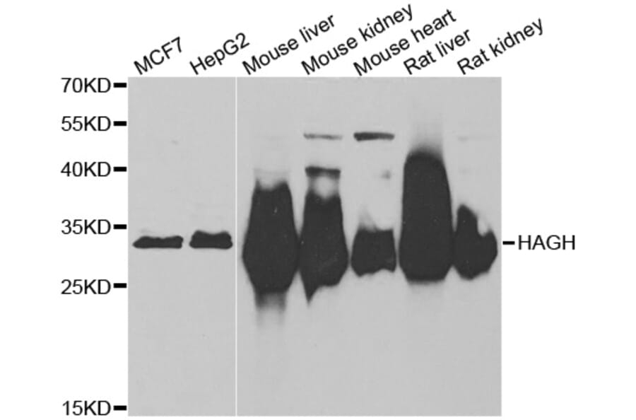 Western blot - HAGH antibody from Signalway Antibody (39047) - Antibodies.com