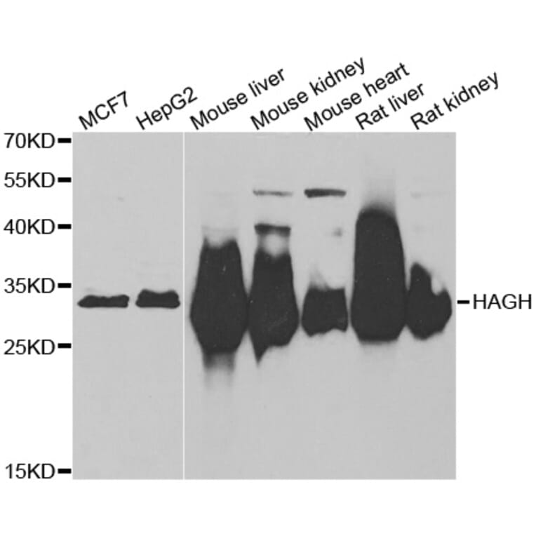 Western blot - HAGH antibody from Signalway Antibody (39047) - Antibodies.com