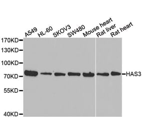 Western blot - HAS3 antibody from Signalway Antibody (39049) - Antibodies.com