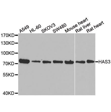 Western blot - HAS3 antibody from Signalway Antibody (39049) - Antibodies.com