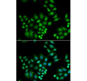 Immunofluorescence - HPS1 antibody from Signalway Antibody (39051) - Antibodies.com