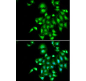 Immunofluorescence - IL20 antibody from Signalway Antibody (39056) - Antibodies.com