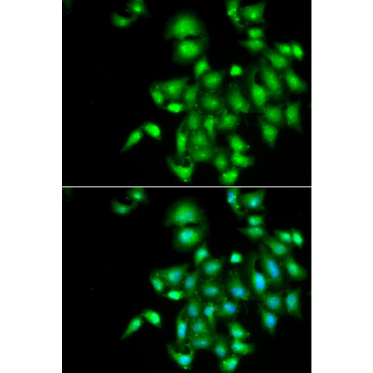 Immunofluorescence - IL20 antibody from Signalway Antibody (39056) - Antibodies.com